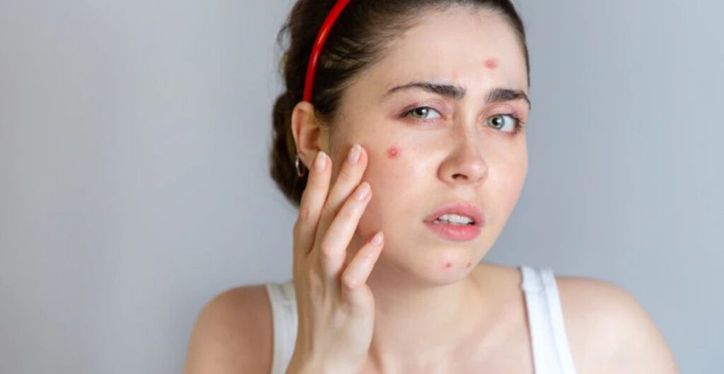 त्वचा की समस्या के लिए घरेलू नुस्खे